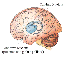 brain lock